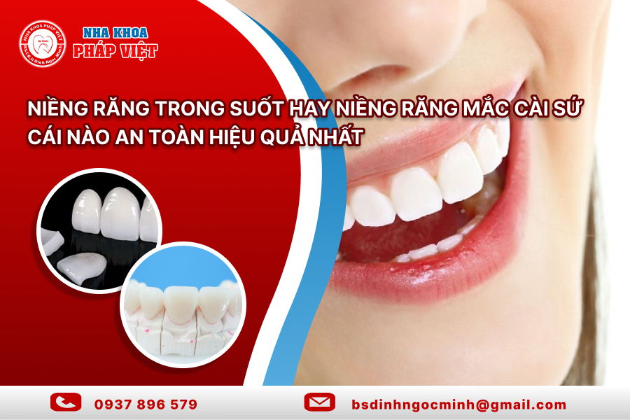 Niềng răng trong suốt hay niềng răng mắc cài sứ, cái nào an toàn hiệu quả nhất